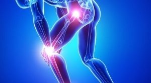 درمان طبیعی درد مفاصل-آرتریت